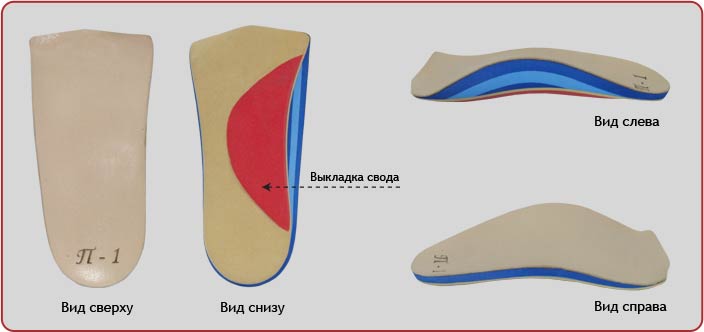 ортопедические стельки при плоскостопии 